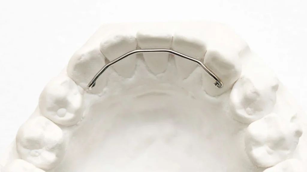 Orthodontiste adulte Meylan 38240