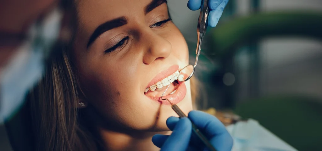 Orthodontie à Meylan