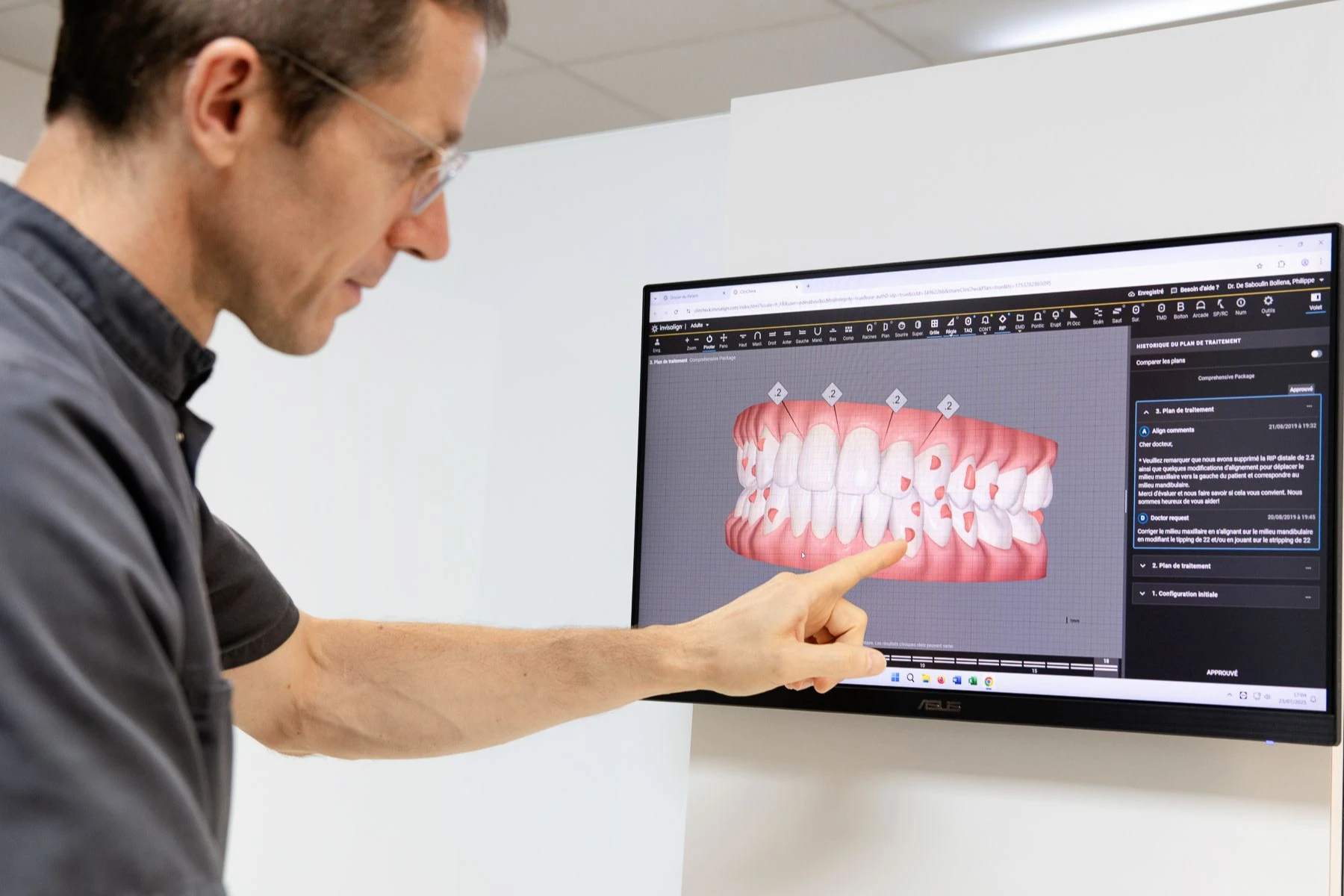 planification-virtuel-orthodontie-meylan