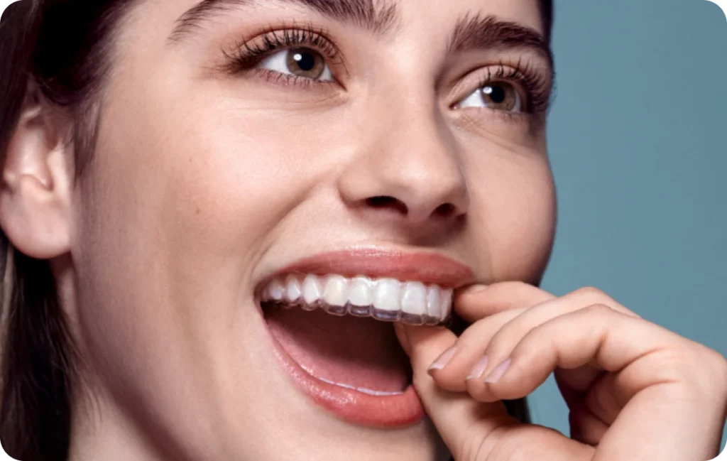 Orthodontie à La Tronche, Orthodontiste La Tronche