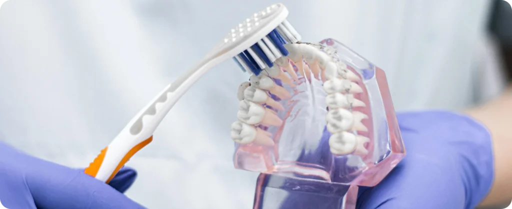 Orthodontie à Biviers, Orthodontiste Biviers