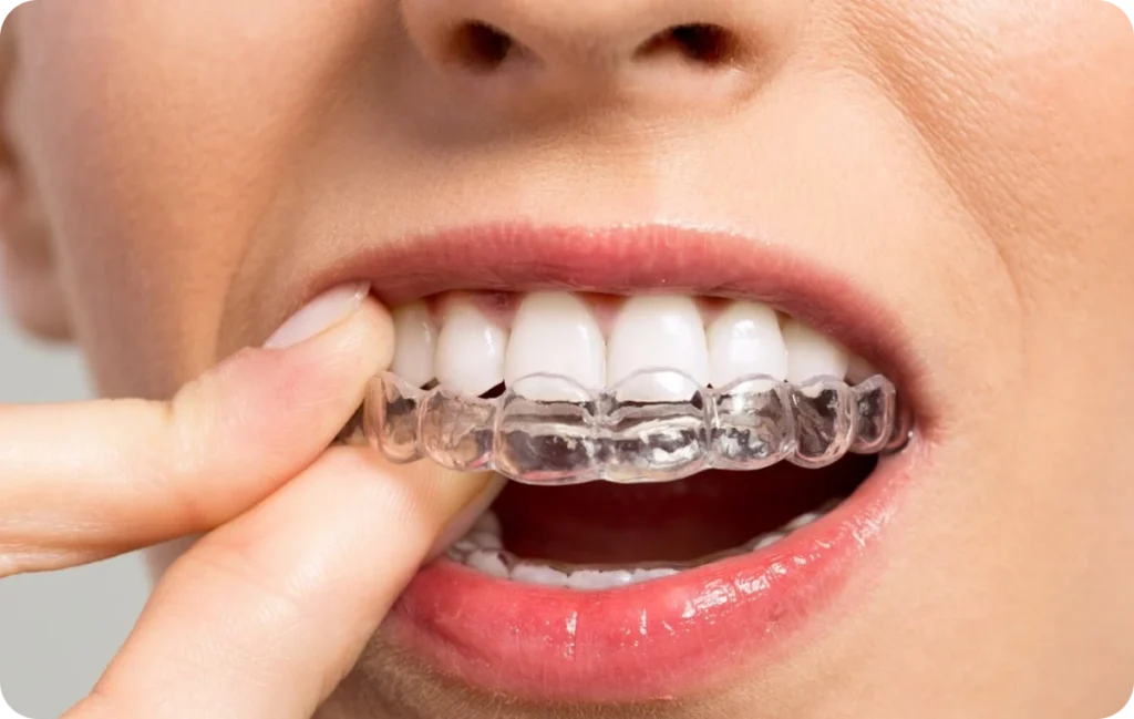 Orthodontie à Corenc, Orthodontiste Corenc