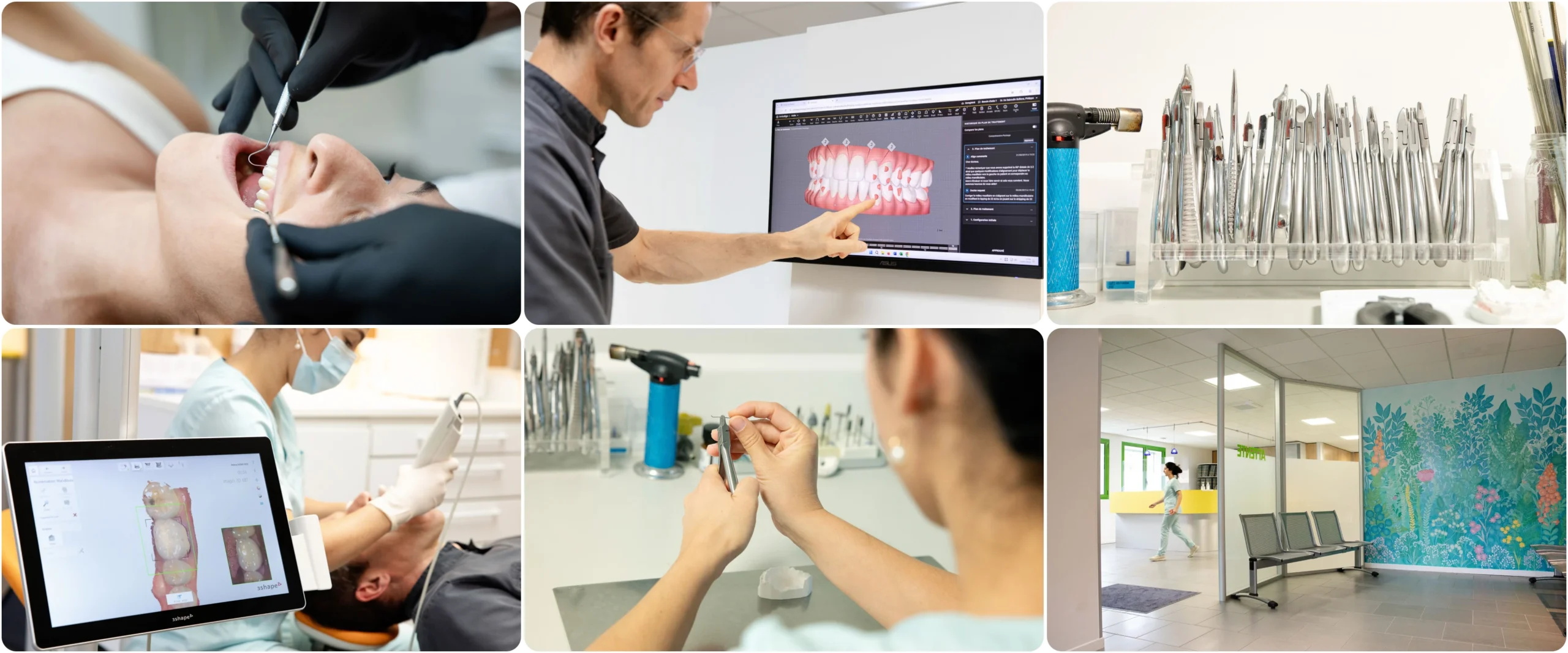 orthodontie-meylan-multi-bagues